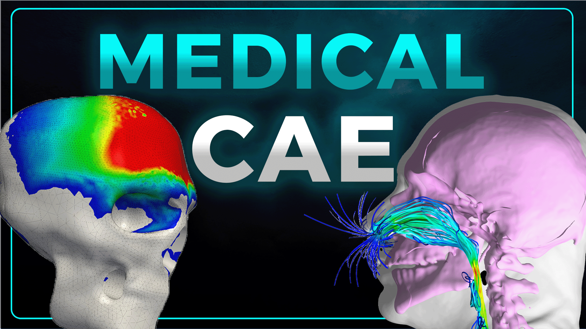 In Silico Medicine: The Power of CAE Biomedical Simulation